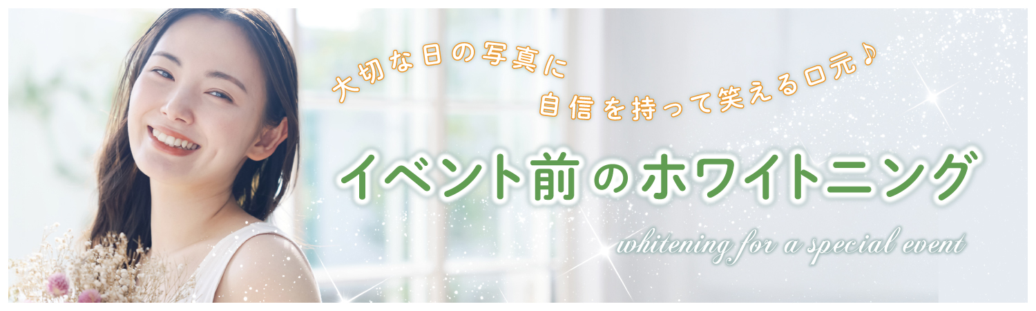 イベント前のホワイトニング